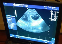 Ultraschall Chili