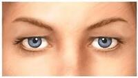 forrás:eyelidslift.com