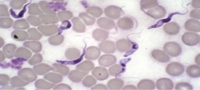 Parasite Trypanosoma Cruzi -20µm- Pfizer-Cominarty Vax