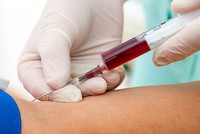 Los análisis de sangre entre los que cabe mencionar las pruebas especiales como Beta- Gonadotropina Corionica Humana, Alfafetoproteina y Lactato Deshidrogenasa son importantes para orientar el diagnostico, en especial de aquellas masas retroperitoneales sin aparentes tumores testiculares