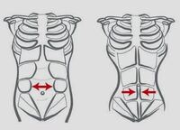 Diástasis abdominal