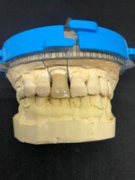 zirconio monolitico e moncone personalizzato dall'operatore programma EXOCAD