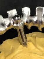 PROTESI FISSA: metallo fresato, per arcata su impianti avvitata