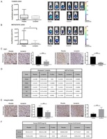 Lycopene reduces ovarian tumor growth and intraperitoneal metastatic load.