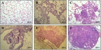 Tobacco carcinogen (NNK) induces both lung cancer and non-alcoholic steatohepatitis and hepatocellular carcinomas in ferrets which can be attenuated by lycopene supplementation.