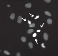 Nuclei of astrocytes marked with Hoechst 33342 and examined under a fluorescence microscope. Arrows identify the nuclei of dead cells and the remaining nuclei represent live cells. From: Phytochemical analysis of hydroethanolic extract of Turnera diffusa Willd and evaluation of its effects on astrocyte cell death.