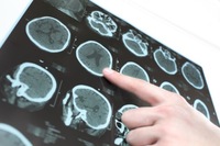 A Radically New Understanding of Alzheimer's Disease Causes and Cures
