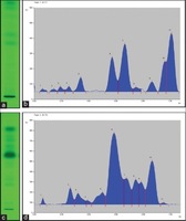 Pharmacognostic Screening of Piper trichostachyon Fruits and its Comparative Analysis with Piper nigrum Using Chromatographic Techniques. (a) Piper trichostachyon high performance thin layer chromatography profile; (b) Piper trichostachyon high performance thin layer chromatography densitogram; (c) Piper nigrum high performance thin layer chromatography profile; (d) Piper nigrum high performance thin layer chromatography densitogram Vinayak Upadhya, et al. Pharmacogn Mag. 2016 May;12(Suppl 2):S152-S158.