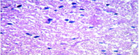 Preventive Role of Indian Black Pepper in Animal Models of Alzheimer’s Disease. Micrograph of brain section of rats taken piper nigrum 20mg/kg body weight, showing no amyloid plaques Lokraj Subedee, et al. J Clin Diagn Res. 2015 Apr;9(4):FF01-FF04.