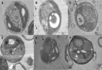 Ecotoxicological effects of carbon nanotubes and cellulose nanofibers in Chlorella vulgaris. TEM results of Chlorella vulgaris exposed to different nanoparticles at 100 μg ml−1 for 48 hours.C. vulgaris cell cultured with Bold’s basal (BB) culture medium only (A), C. vulgaris cell cultured with Multi-walled carbon nanotubes (MWCNTs) in BB culture medium (B), C. vulgaris cell cultured with cotton cellulose nanofibers (CNFs) in BB culture medium (C); C. vulgaris cell cultured with Seine river water only (D), C. vulgaris cell cultured with MWCNT in Seine river water (E), C. vulgaris cell cultured with cotton CNFs in Seine river water (F). MWCNTs (small black tubes) are inside the cell (B) while there is no evidence of cotton CNFs was found inside the cells. Black arrows: extracellular MWCNTs or cotton CNF; white arrows: intracellular MWCNTs. Michele M Pereira, et al. J Nanobiotechnology. 2014;12:15-15