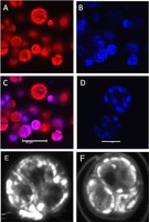 Potential of Fluorescence Imaging Techniques To Monitor Mutagenic PAH Uptake by Microalga. (A) Confocal microscopy image of Chlorella cells showing background photosystem fluorescence. (B) Confocal microscopy image showing BaP fluorescence in Chlorella cells. (C) Overlap of Chlorella sp. background fluorescence and BaP fluorescence (scale bar = 20 μm). (D) Higher-magnification image showing fluorescence of BaP inside Chlorella sp. cells (scale bar = 5 μm). (E) Confocal microscopy image of a Chlorella cell showing pictate staining of BaP fluorescence. (F) Confocal microscopy image of a Chlorella cell showing the lipid-specific fluorescent stain Nile red. Suresh Ramraj Subashchandrabose, et al. Environ Sci Technol. 2014 Aug 19;48(16):9152-9160