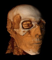 3D CT image of the head of Seti I shows the fillers the embalmers placed underneath the skin to look live