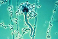 Micotoxina