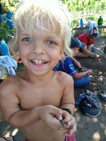 Crianças com acondroplasia