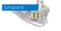 SIMPLANT SOFTWARE