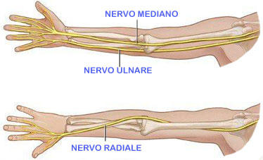 I 10 Igliori Goito Tutore Per L'intrappolaento Del Nervo Ulnare Del - Foto 13