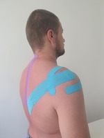 Taping a kinesiotaping ramena a chrbta, regenerácia kĺbov, svalov a väziva, tejpovanie pre športovcov, stabilizácia kĺbov