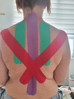 Taping a kinesiotaping - korekcia chybného držania tela, tejpovanie chrbta a lopatiek proti bolesti