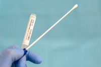 Foto zdroj: https://forbes.com.br/negocios/2020/05/bradesco-comeca-a-aplicar-testes-de-covid-19-em-funcionarios/