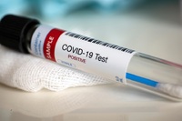 Foto zdroj: https://www.gov.uk/government/news/gad-helps-with-modelling-and-analysis-in-test-and-trace