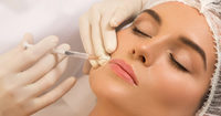 Trattamento filler labiale con acido ialuronico