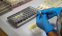 Toma de muestras en laboratorios