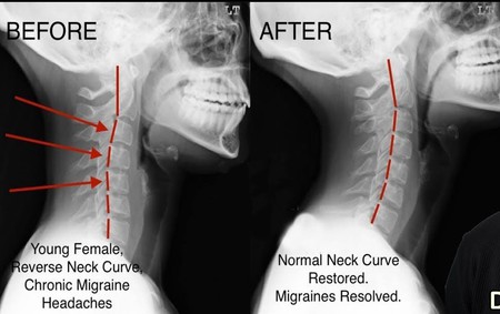 reverse neck curve pillow