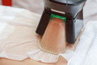 Overtollig vet verwijderen – Cryolipolyse