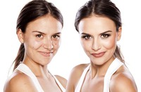 Revitalización Facial con Vitaminas